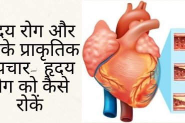 Reasons of Heart Disease