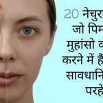 Home Remedies for Pimple