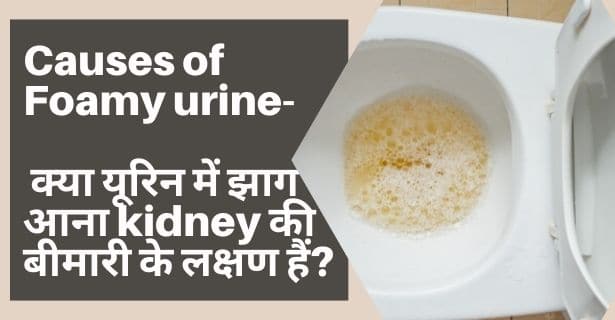 यूरिन में झाग Causes of Foamy urine