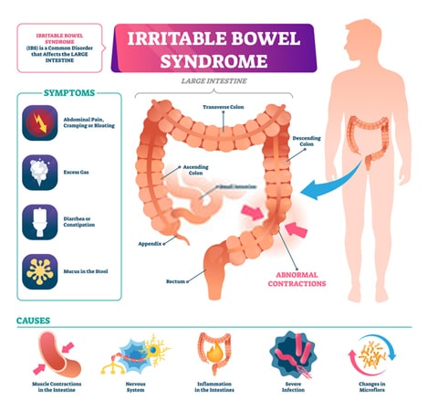 Turmeric for IBS